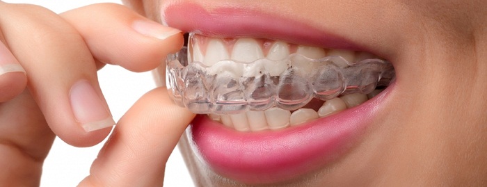 Grinding Teeth at Night: 5 Tips to Help You Stop